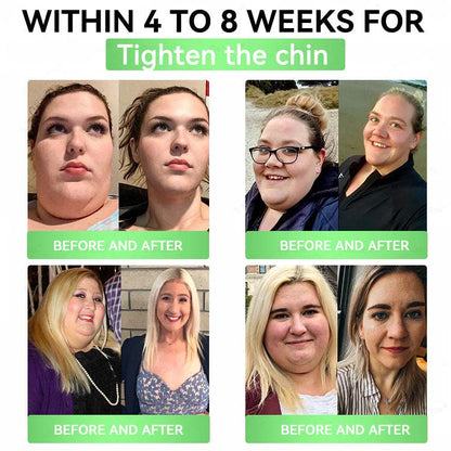 🔥Alcuras® Moringa 8-Benefit Slimming & Metabolic Nano Microneedle changes in 7 days)  For obesity, Loose Skin,diabetes, sleep apnea, joint issues, and more