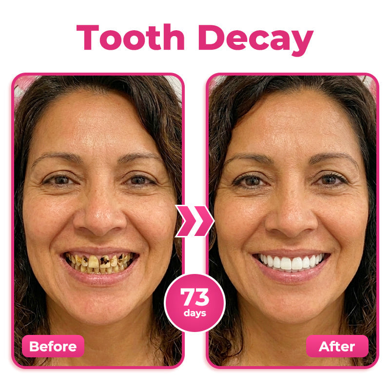 Alcuras® Thismile NH-10 Enamel & Gum Advanced Therapy Toothpaste Serum