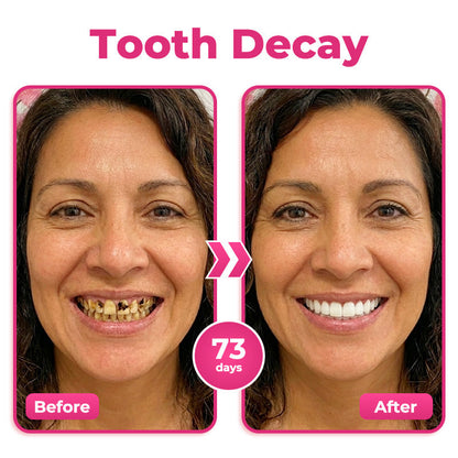 Alcuras® Thismile NH-10 Enamel & Gum Advanced Therapy Toothpaste Serum