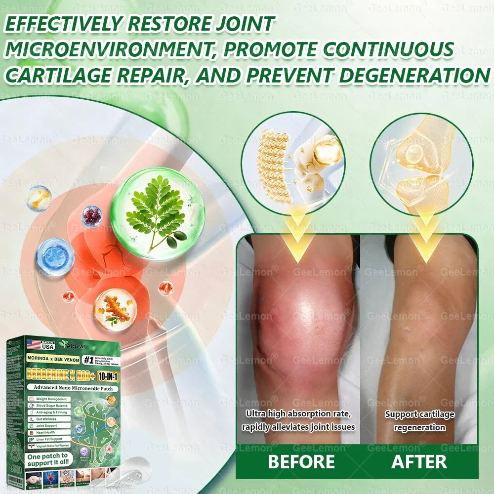 Alcuras® Moringa · Berberine × NAD+ 𝟏𝟎-𝐢𝐧-𝟏 𝐀𝐝𝐯𝐚𝐧𝐜𝐞𝐝 𝐍𝐚𝐧𝐨 𝐌𝐢𝐜𝐫𝐨𝐧𝐞𝐞𝐝𝐥𝐞 𝐏𝐚𝐭𝐜𝐡 — 𝐎𝐧𝐜𝐞 𝐃𝐚𝐢𝐥𝐲, 𝐕𝐢𝐬𝐢𝐛𝐥𝐞 𝐑𝐞𝐬𝐮𝐥𝐭𝐬 𝐢𝐧 𝟕 𝐃𝐚𝐲𝐬