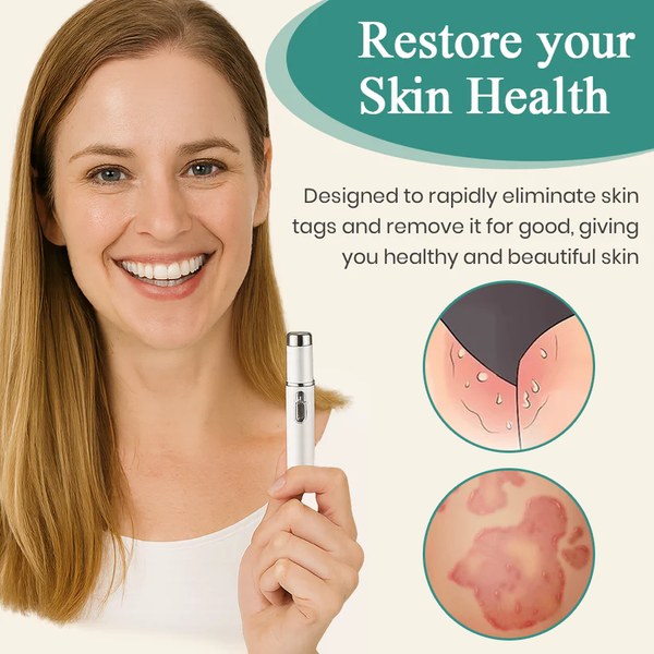 Mresio® HPV Genital Warts Removal Laser Pen