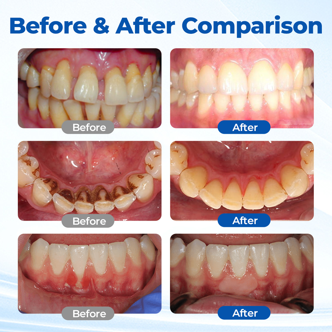 Alcuras® GumBiome Recovery Gel