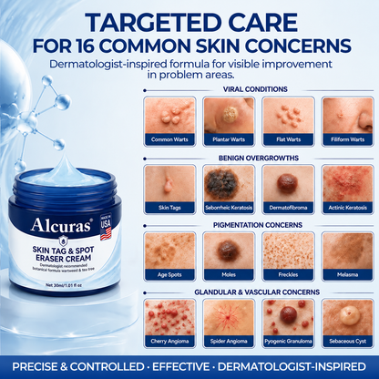 Alcuras® 7-Day Skin Tag & Spot Eraser Cream