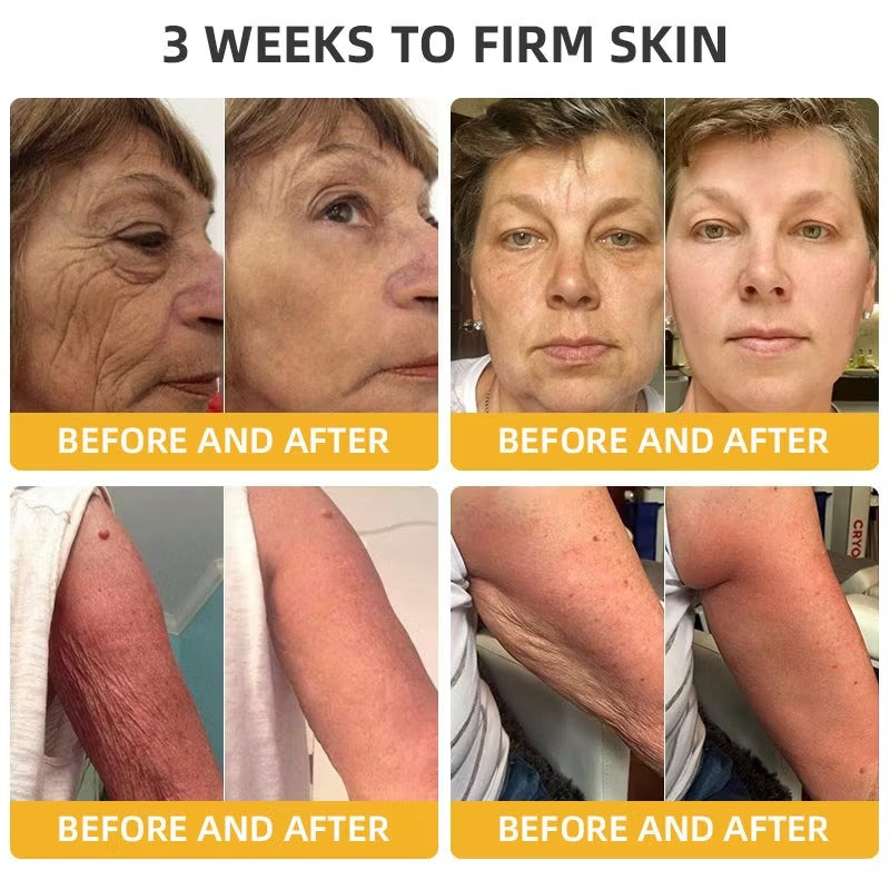BeeLift Anti-Aging Firming Cream,Address Crepe & Sagging(🔥49% Off for a Limited Time!)