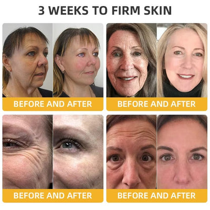 BeeLift Anti-Aging Firming Cream,Address Crepe & Sagging(🔥49% Off for a Limited Time!)
