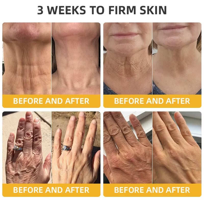 BeeLift Anti-Aging Firming Cream,Address Crepe & Sagging(🔥49% Off for a Limited Time!)