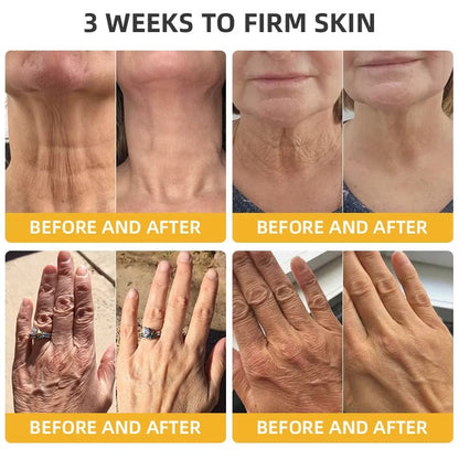 BeeLift Anti-Aging Firming Cream,Address Crepe & Sagging(🔥49% Off for a Limited Time!)
