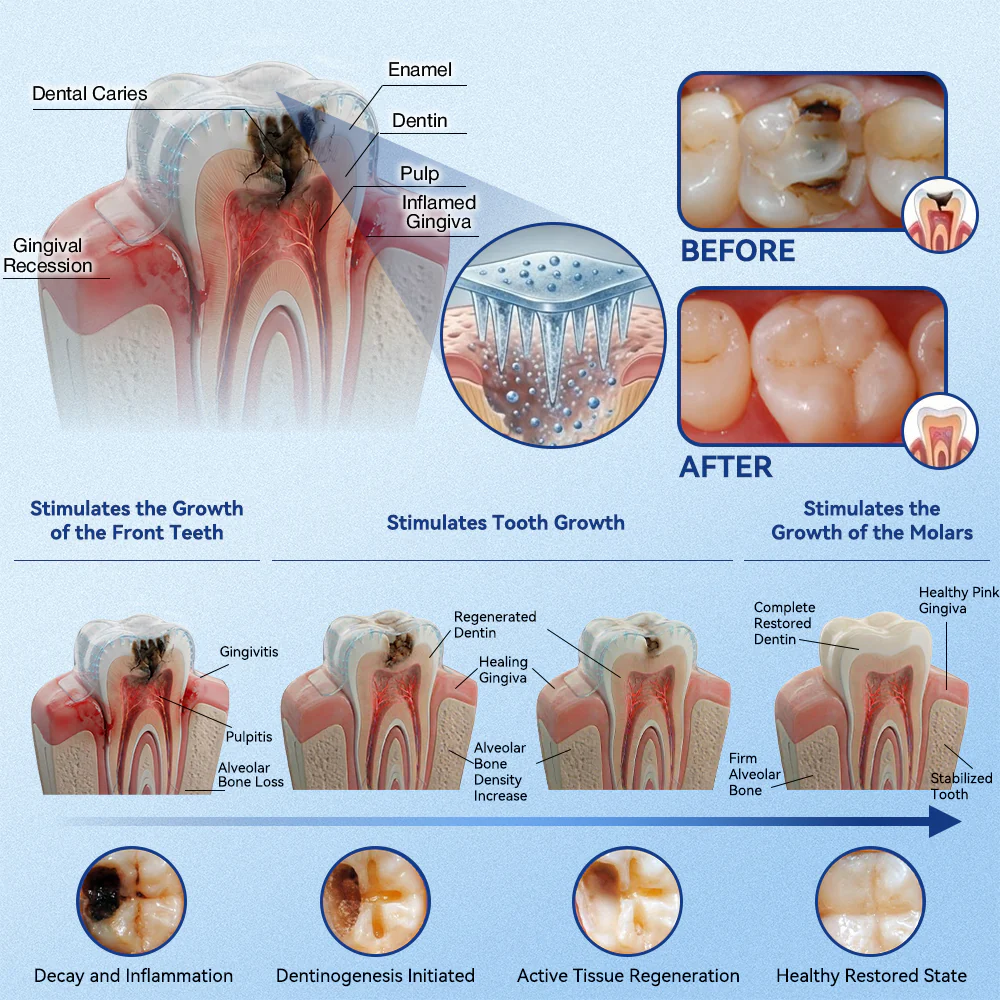 🦷Alcuras®️ Fast-Dissolving Tooth & Gum CareOral Strips - Daily Oral WellnessSupport