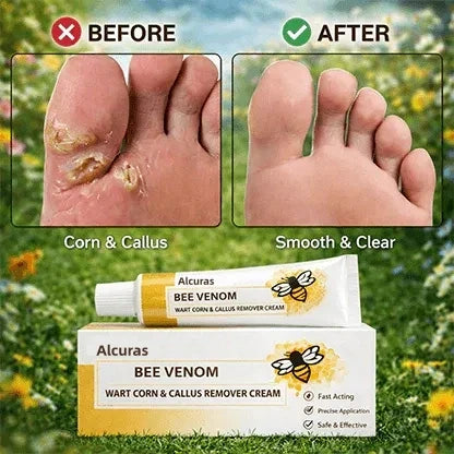 Alcuras®️ The Promise: Sandal Confidence Again—Without Shame, Without Pain, Without Recurrence