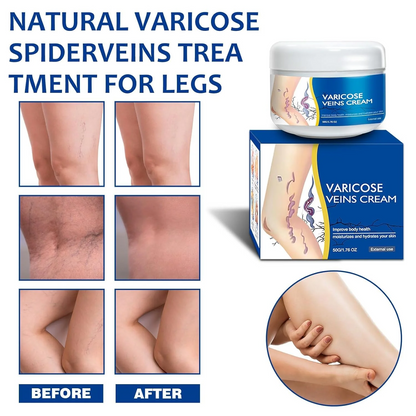 🎉Buy One Get One Free🎁 -Alcuras® Fast‑Absorbing Varicose Veins Care Cream For Smooth, Light, Confident Legs🦵
