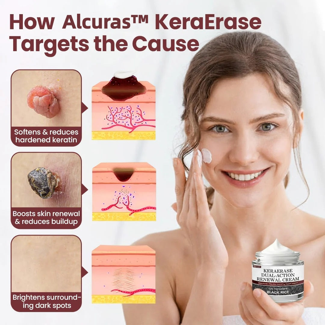 🔥Alcuras™ KeraErase Dual-Action Renewal Cream