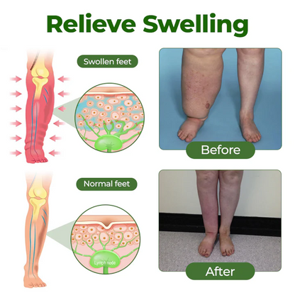 Alcuras™ Professional Leg Circulation Cream